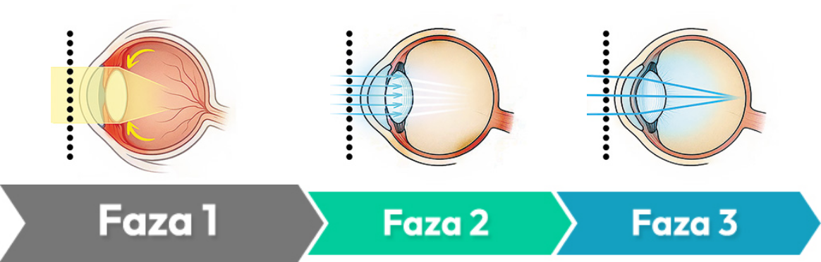 product-stages-image